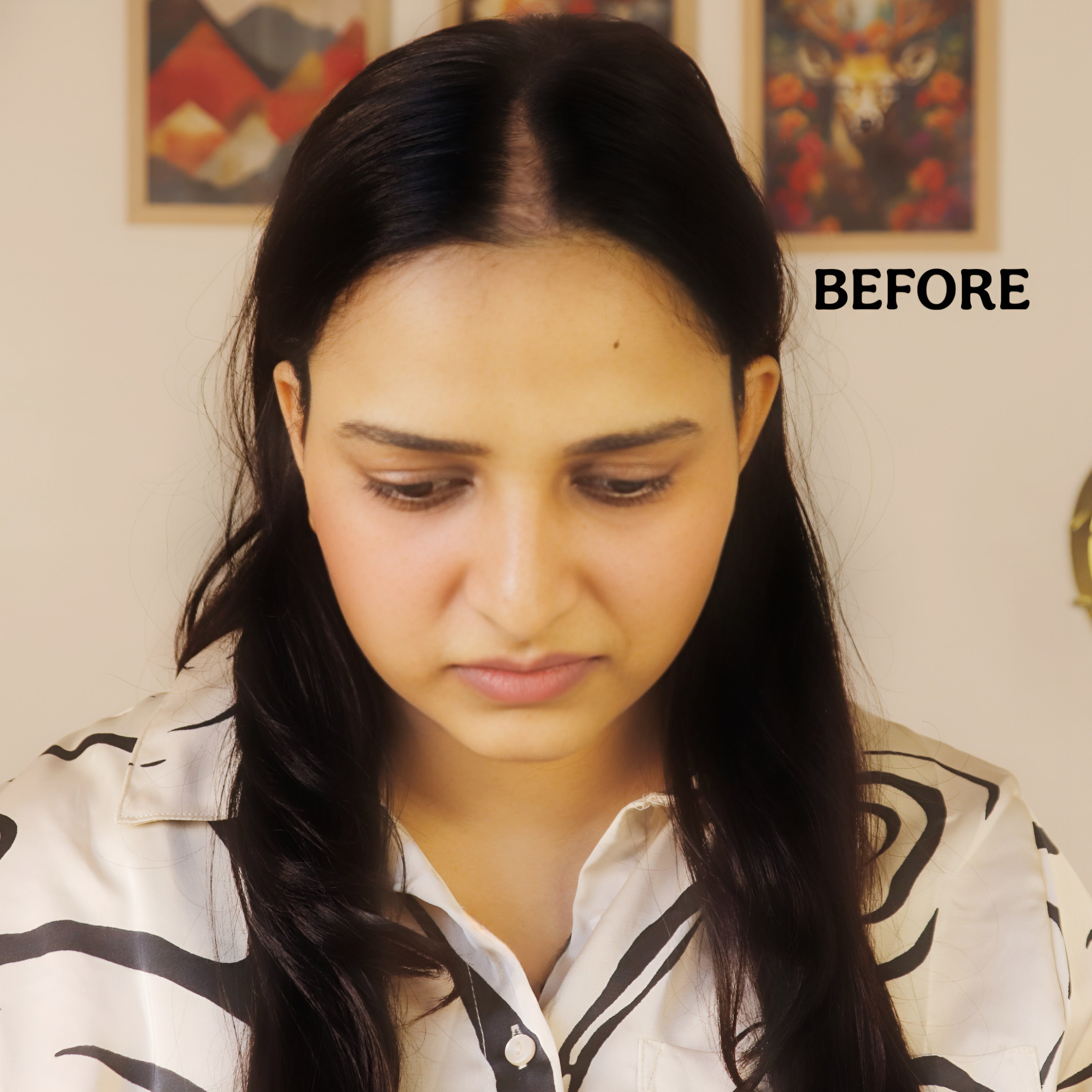 Vidya Scalp Topper -Crown Coverage Accessory