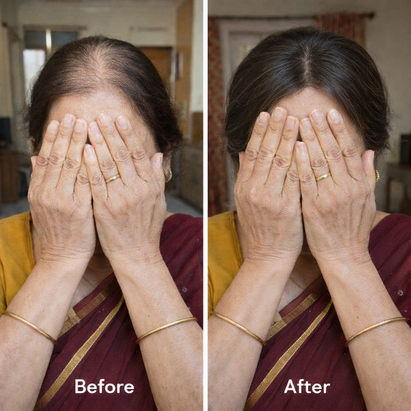 Scalp Topper -Crown Coverage Accessory