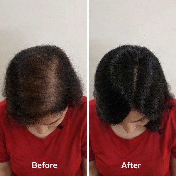 Scalp Topper -Crown Coverage Accessory